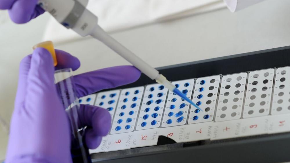 Dritter Hantavirus-Verdachtsfall in Großbritannien gemeldet