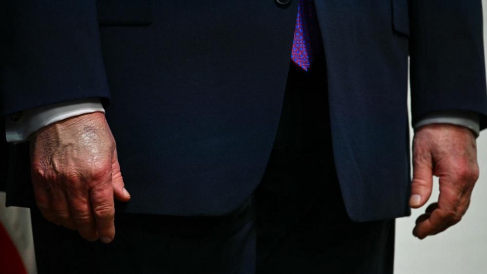 Arzt bescheinigt US-Präsident Trump beste Gesundheit
