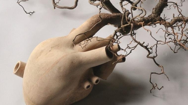 Eines von Gregor Pruggers Werke. Foto: Stol