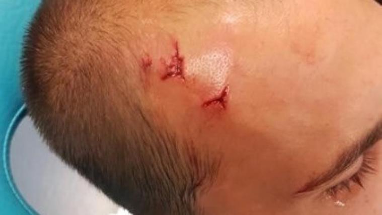Bas Dost verletzte sich am Kopf. © Twitter