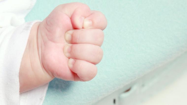 In Portugal ist ein Baby ohne Gesicht zur Welt gekommen.