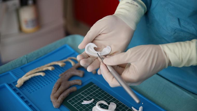 Mithilfe eines 3D-Druckers wurde in Florenz eine Ohrmuschel gefertigt.