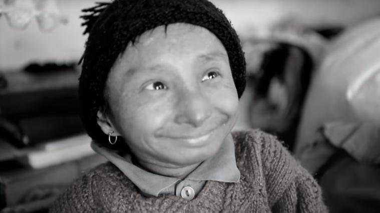Der 28-Jährge hatte „Primordial Dwarfism“, eine Form von Zwergenwuchs.