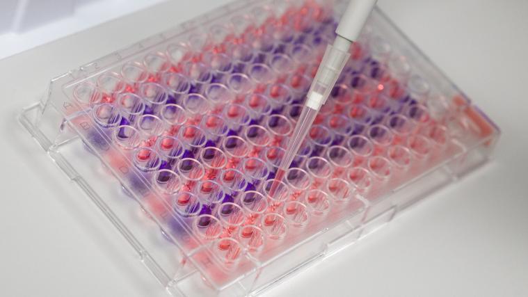 Forscher in Rom konnten den Coronavirus isolieren.