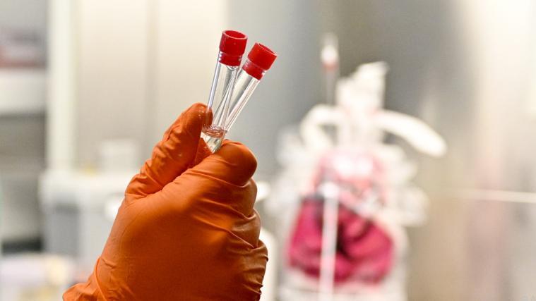 In den USA gibt es den ersten Coronavirus-Todesfall.