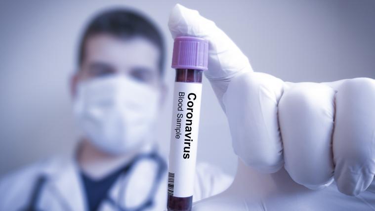 Das Coronavirus verleitet Menschen bereits zu rassistisch motivierten Taten.