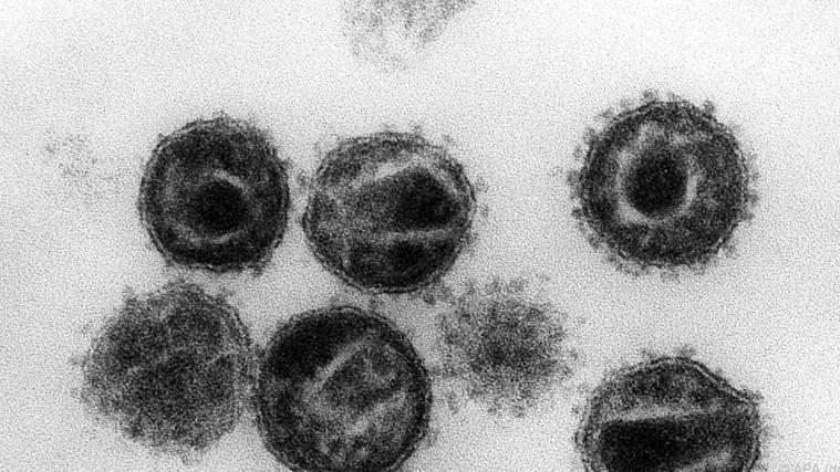 Elektronenmikroskopische Aufnahme mehrerer HIV-Erreger.