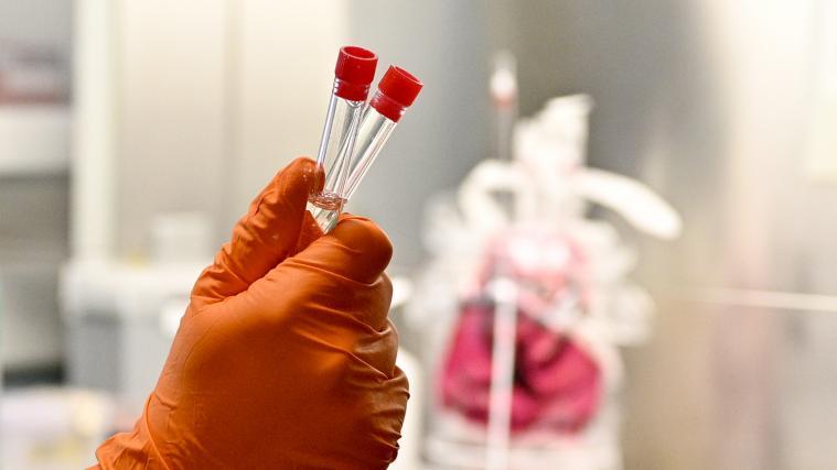 Laboruntersuchung zur Abklärung des Coronavirus aufgenommen.