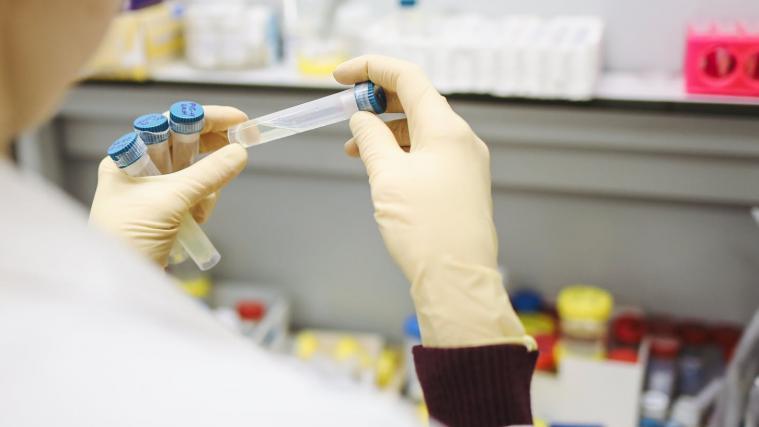 156.000 Menschen wurden in Italien positiv auf das Virus getestet.