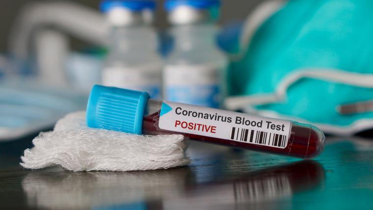 Im Kampf gegen das Coronavirus sollen in Italien Antikörper-Tests durchgeführt werden.