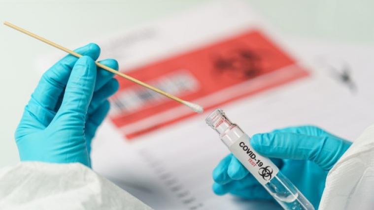 Im Auftrag des Südtiroler Sanitätsbetriebs wurden bisher insgesamt 67.965 Abstriche untersucht.