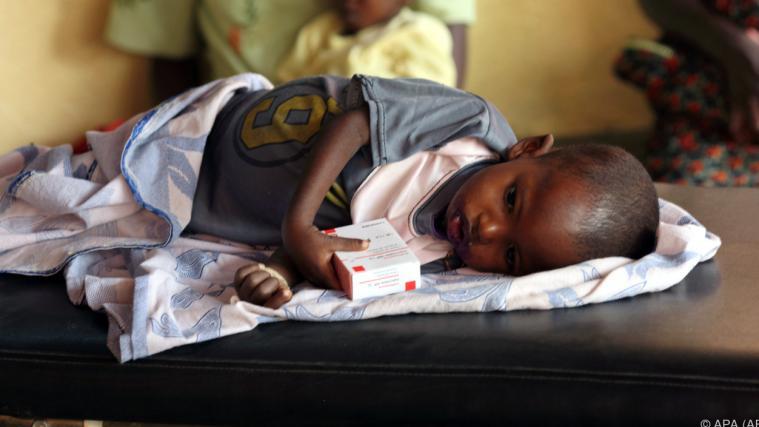 47 Millionen Kinder weltweit seien akut unterernährt, warnte die Caritas.