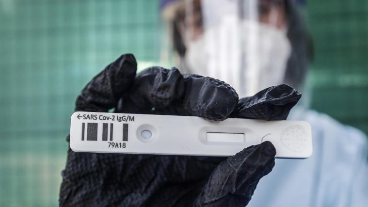 Italiens Gesundheitsbehörden zeigen sich mit der epidemiologischen Entwicklung verhalten zufrieden.