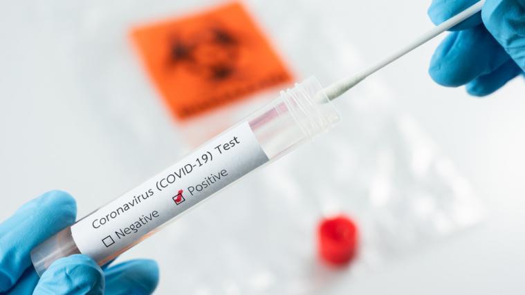 Der Anstieg der Covid-19-Infektionszahlen in Italien sorgt für Kopfzerbrechen.