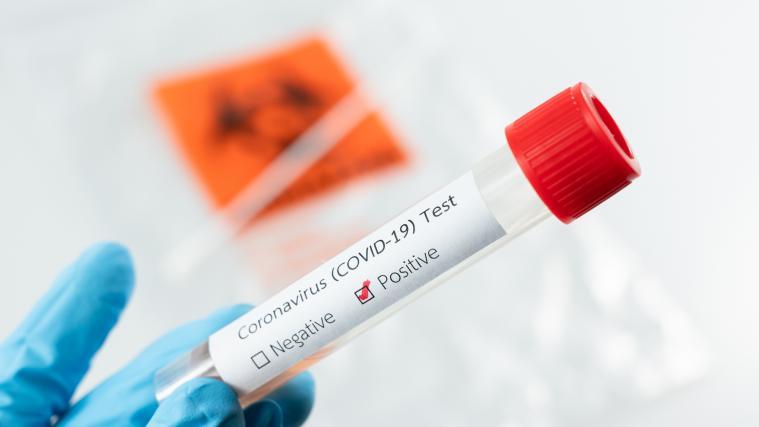 In den vergangenen 24 Stunden wurden 1281 Abstriche auf das neuartige Coronavirus untersucht. Dabei wurden 8 Neuinfektionen festgestellt.