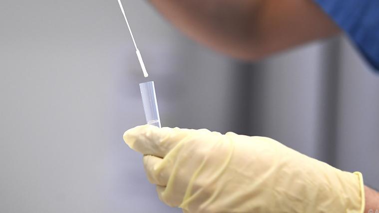 Erstmals wurden in Österreich mehr als 20.000 Tests innerhalb von 24 Stunden eingemeldet.