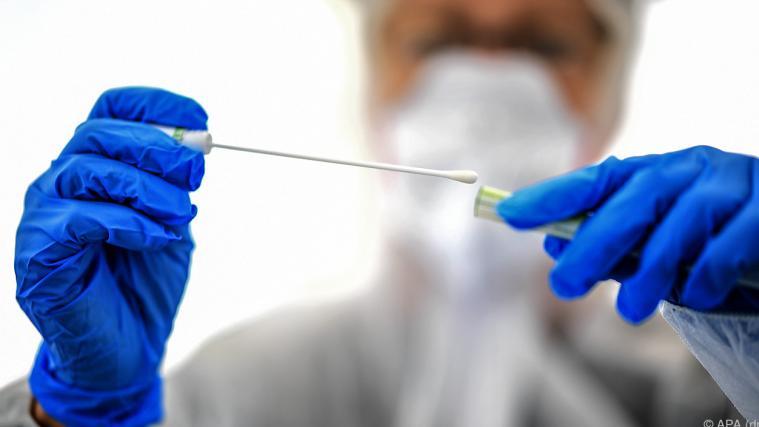 9930 Personen sind in Österreich aktiv mit dem Coronavirus infiziert.