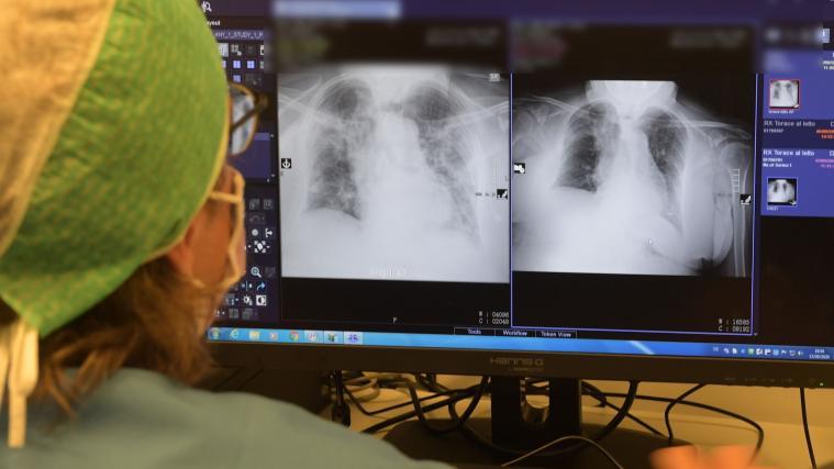 Die Zahl der in Spitälern behandelten Covid-19-Patienten stieg in den vergangenen 24 Stunden italienweit auf 3625.