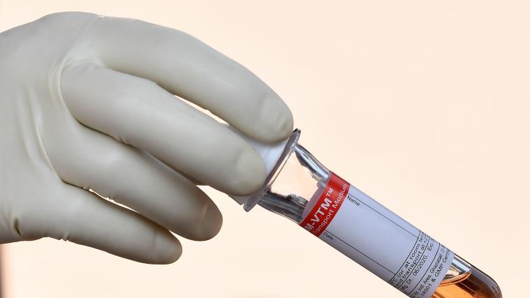 Ein deutliches Plus gab es in Österreich innerhalb einer Woche bei Intensivpatienten - sie stiegen von 88 am vergangenen Montag auf 101, was einer Zunahme von knapp 15 Prozent bedeutet.