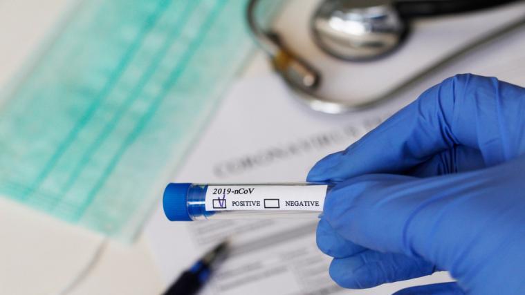 33 Patienten werden derzeit auf Intensivstationen behandelt.