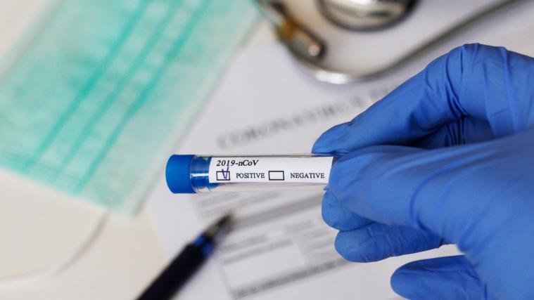 Innerhalb von 24 Stunden wurde eine Rekordzahl von 254.908 Tests durchgeführt.