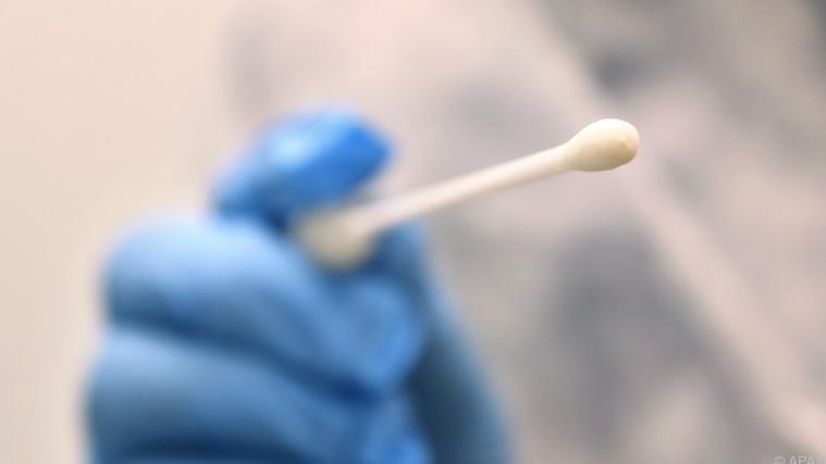 22.459 Neuinfektionen innerhalb von 24 Stunden wurden in Deutschland gemeldet.