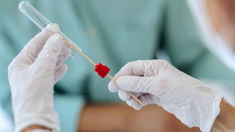 Binnen 24 Stunden wurden 185.320 Tests durchgeführt, 9,8 Prozent davon fielen positiv aus.