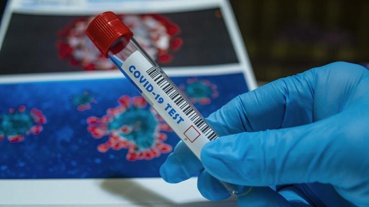 Die Coronavirus-Neuinfektionen sind gesunken.