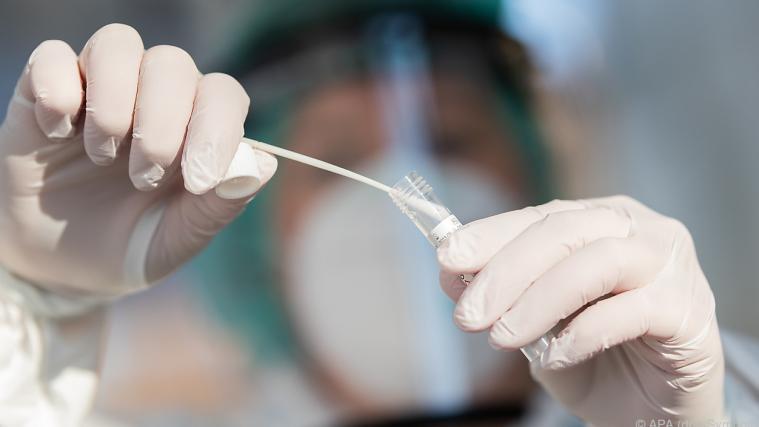Das Coronavirus hält Italien weiter in Atem.