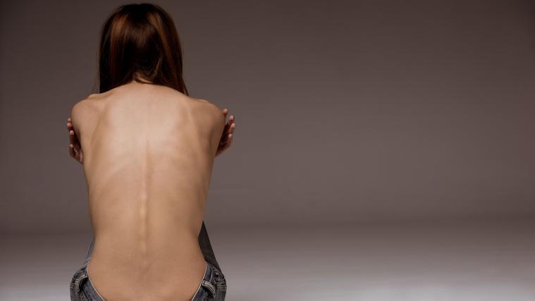 Am häufigsten betroffen von Essstörungen sind Mädchen zwischen 12 und 15 Jahren.