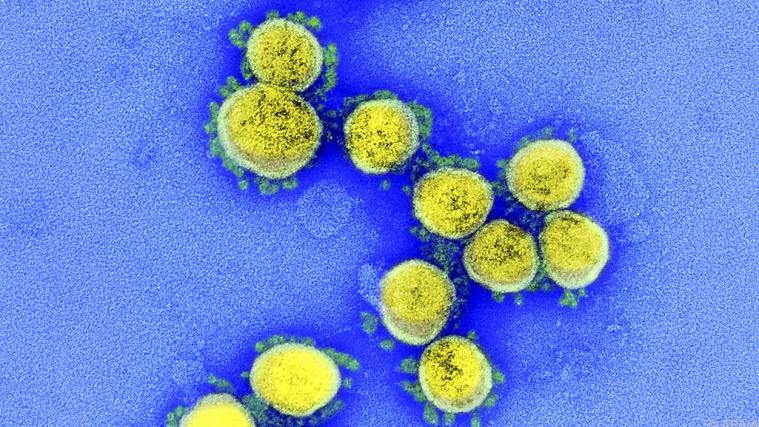 Das Coronavirus hält Italien weiterhin in Schach.