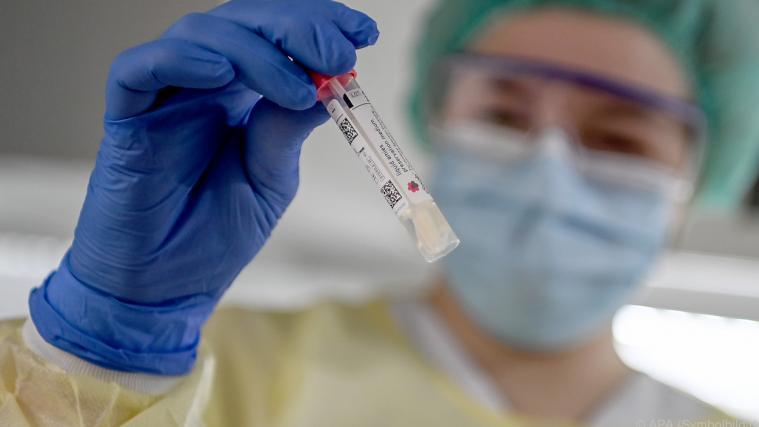 0,4 Prozent der untersuchten Tests fielen positiv aus.