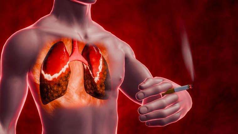 elfbar elfa kaufen Studie: Vapes verursachen ziemlich sicher Mund- und Lungenkrebs